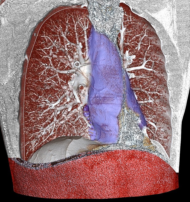 Mediastinum and Pericardial Cavity - Side by Side Comparison 