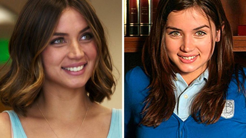 Did Ana de Armas Undergo Plastic Surgery Including Boob Job, Nose Job