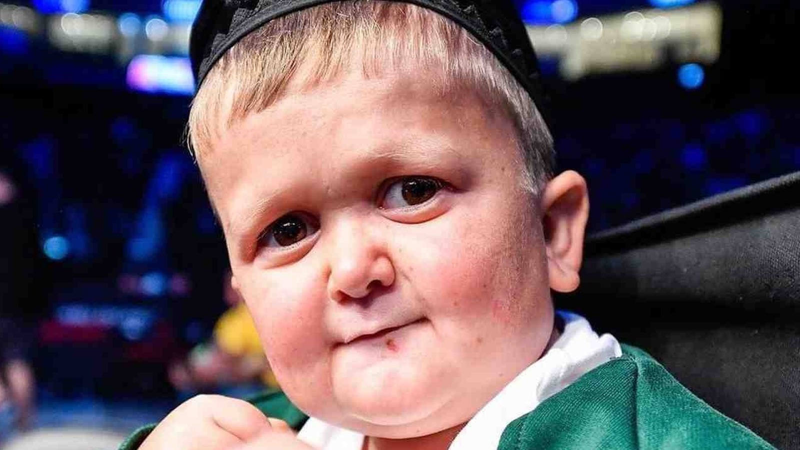 The Theory About Hasbulla Magomedov's Rare Condition