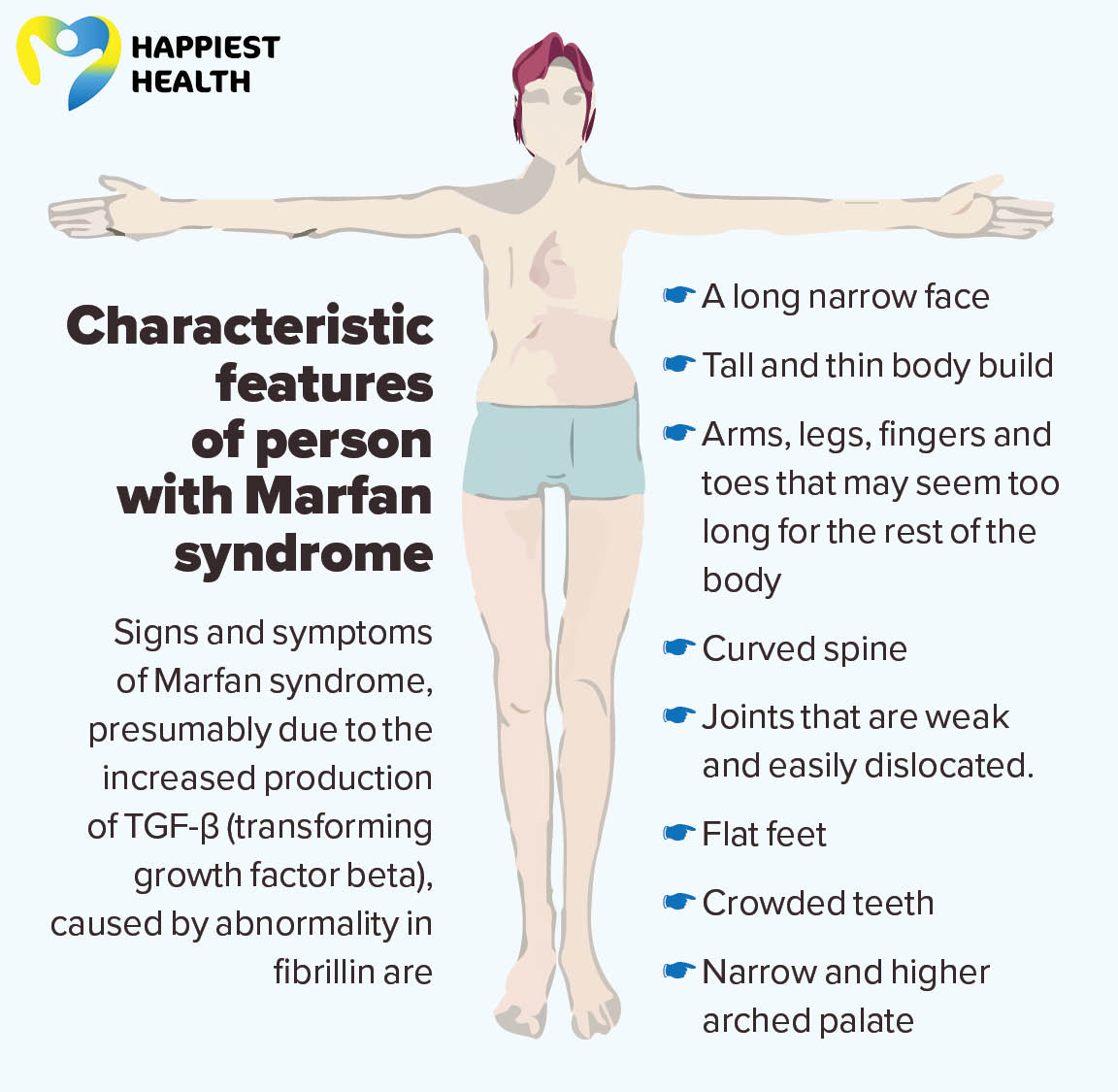 Marfan syndrome Cause and Diagnosis Happiest Health