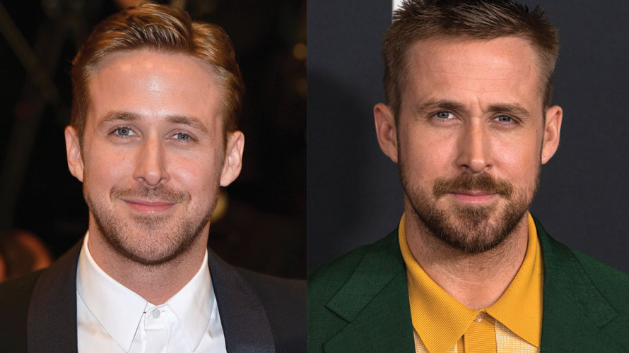 Ryan Gosling Plastic Surgery Before and After Pictures 2024