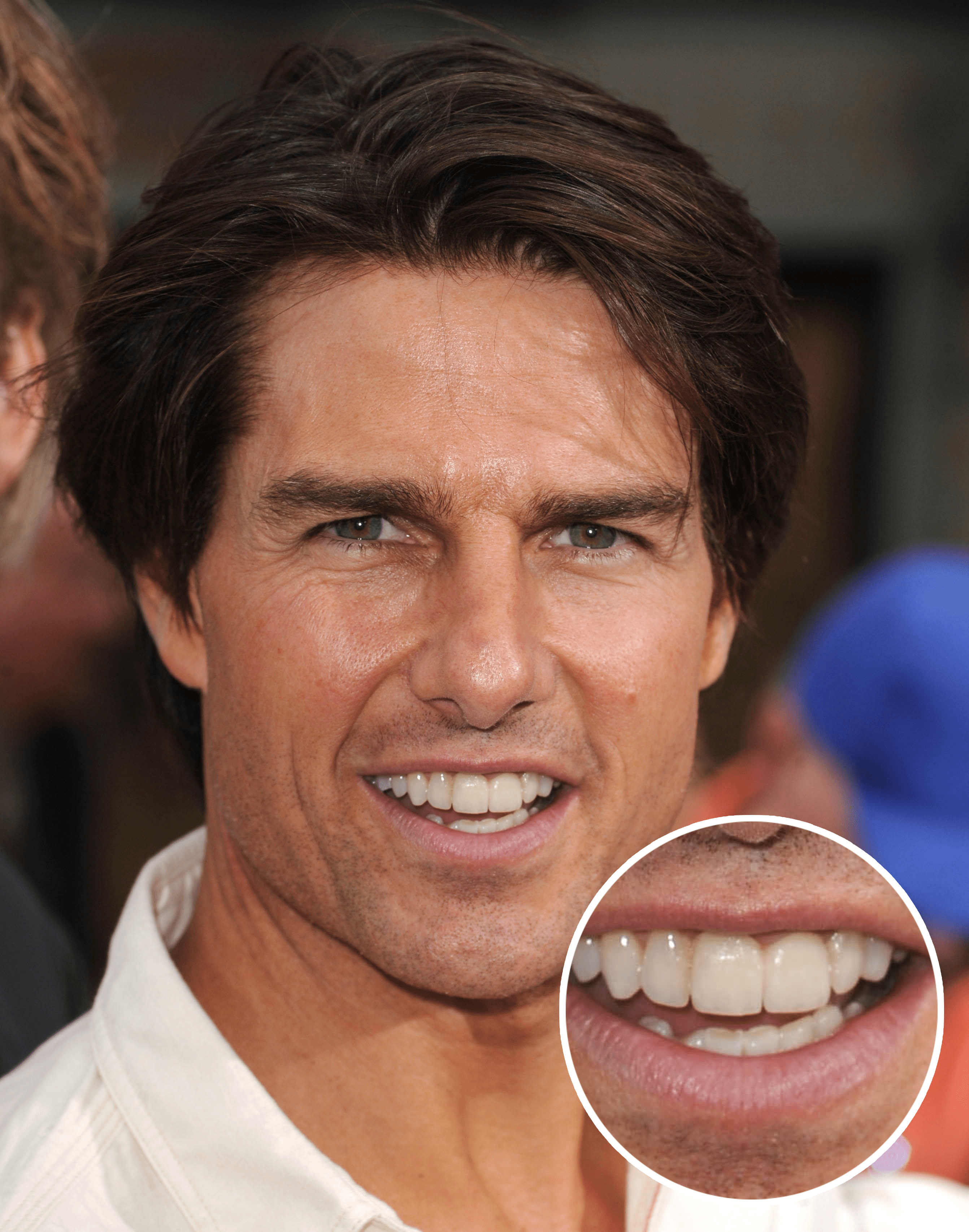 Tom Cruise's Middle Tooth — the Story Behind His Smile