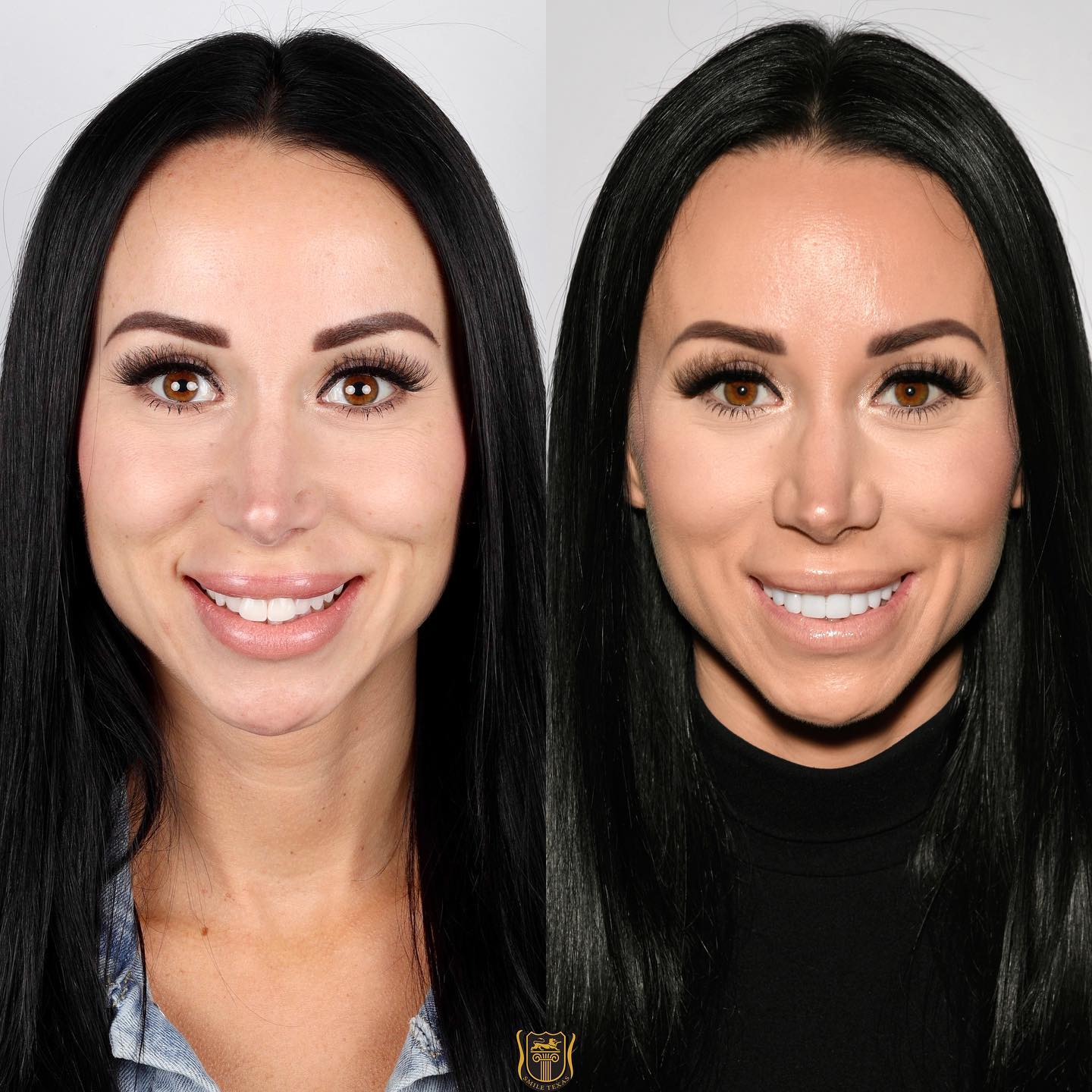 RHONJ's Rachel Fuda Plastic Surgery Nose Job Photos