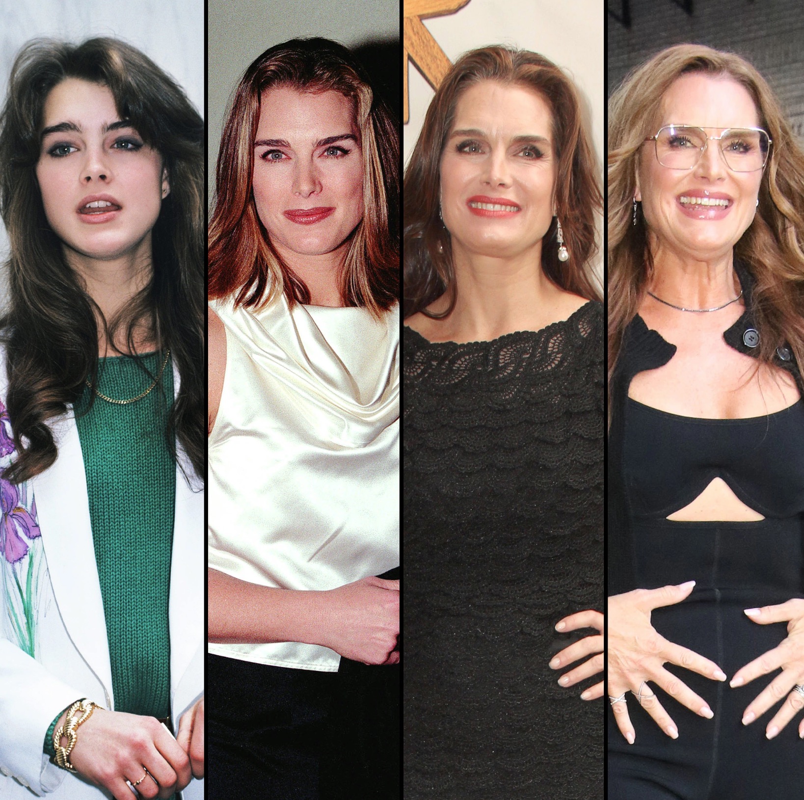 Has Brooke Shields Had Plastic Surgical Procedures? Transformation