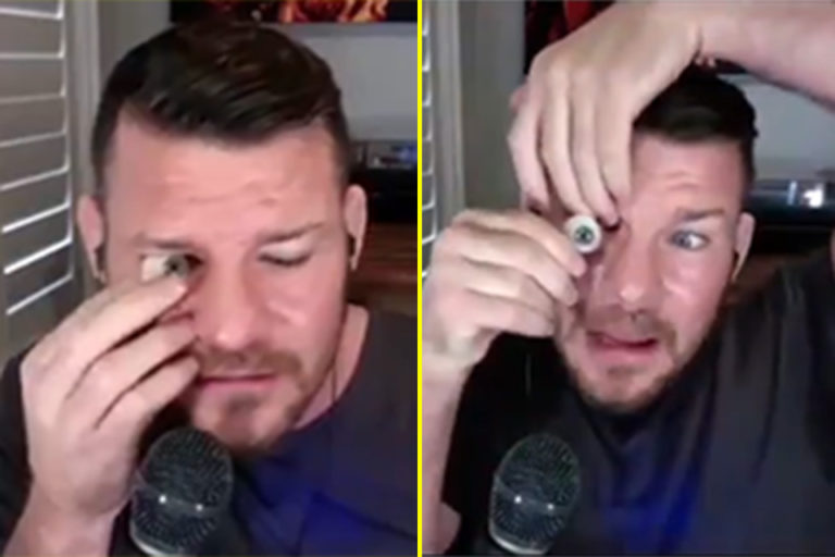 Watch Former UFC Middleweight champion Michael Bisping pops out his