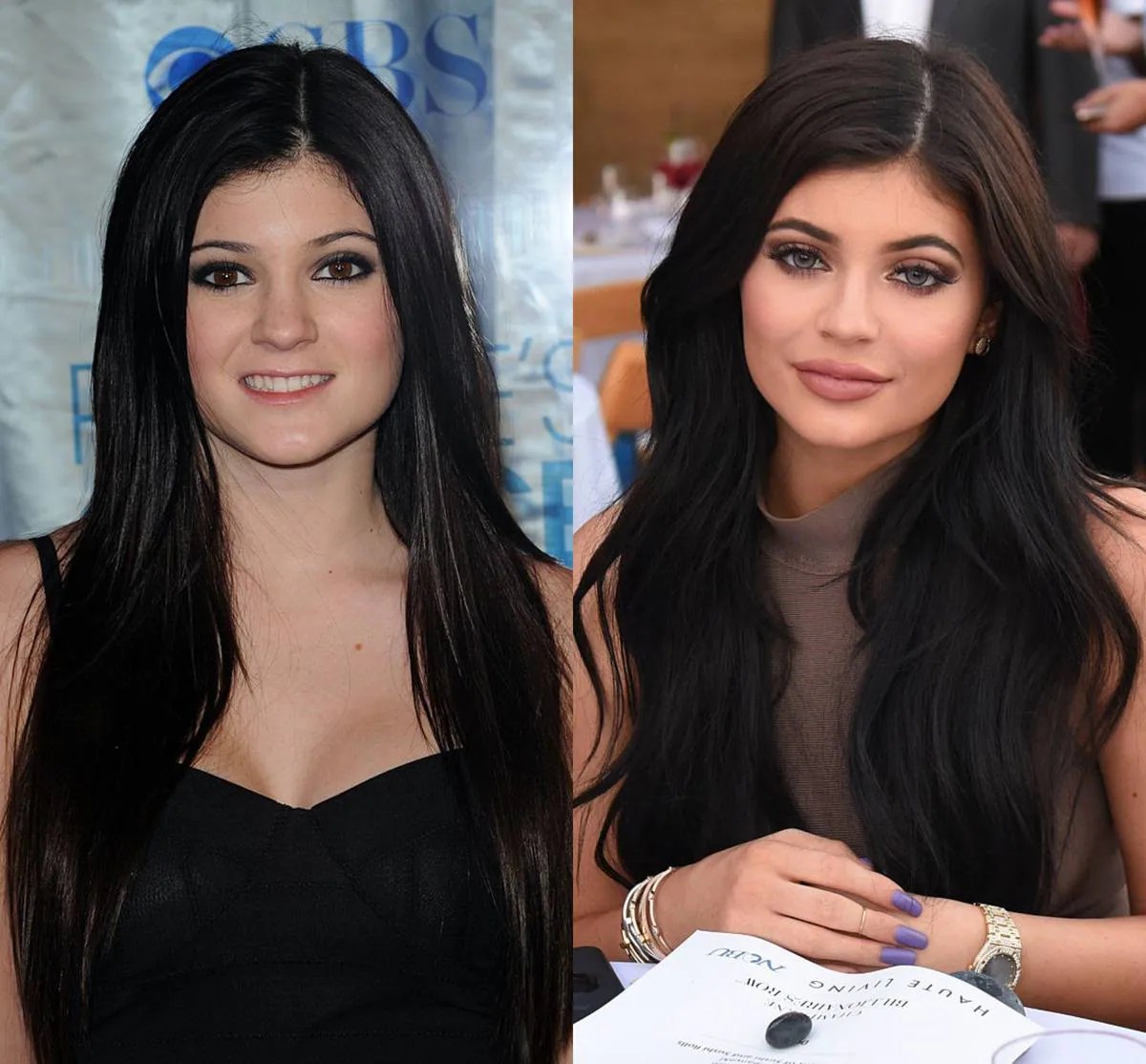 Fans shocked by changing face of Kylie Jenner NZ Herald