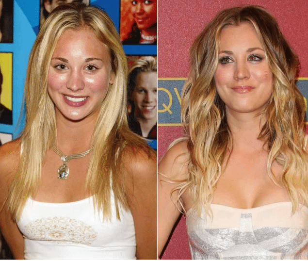 Reasonable Expectations Kaley Cuoco Pacific Heights Plastic Surgery