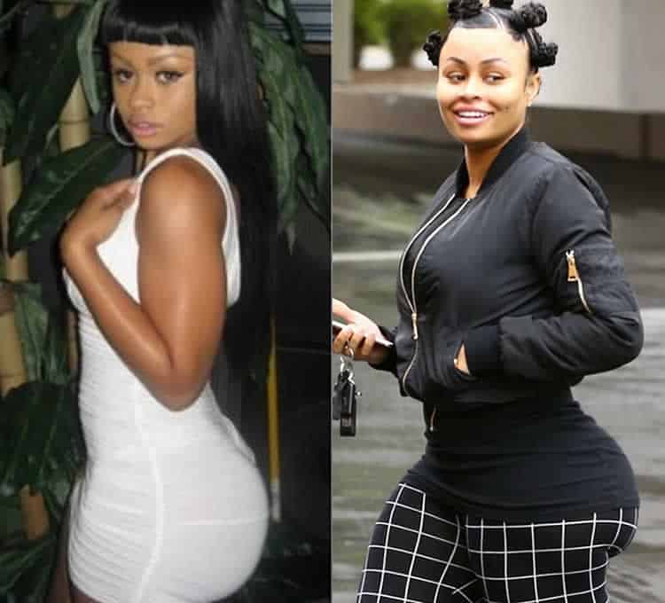 Blac Chyna Plastic Surgery EXPOSED? (Before & After Photos 2018)