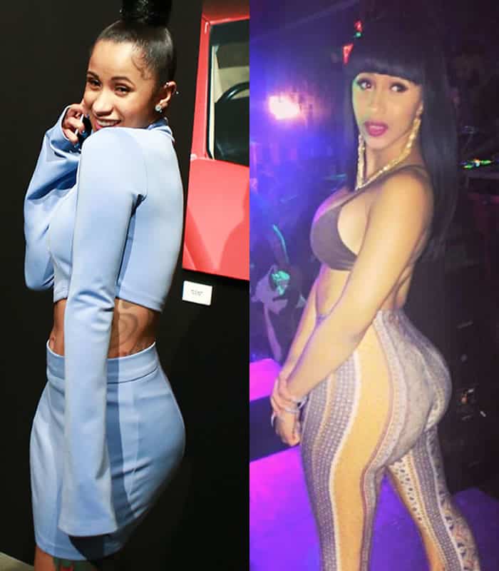 Cardi B Plastic Surgery REVEALED! (Before & After Photos 2021)