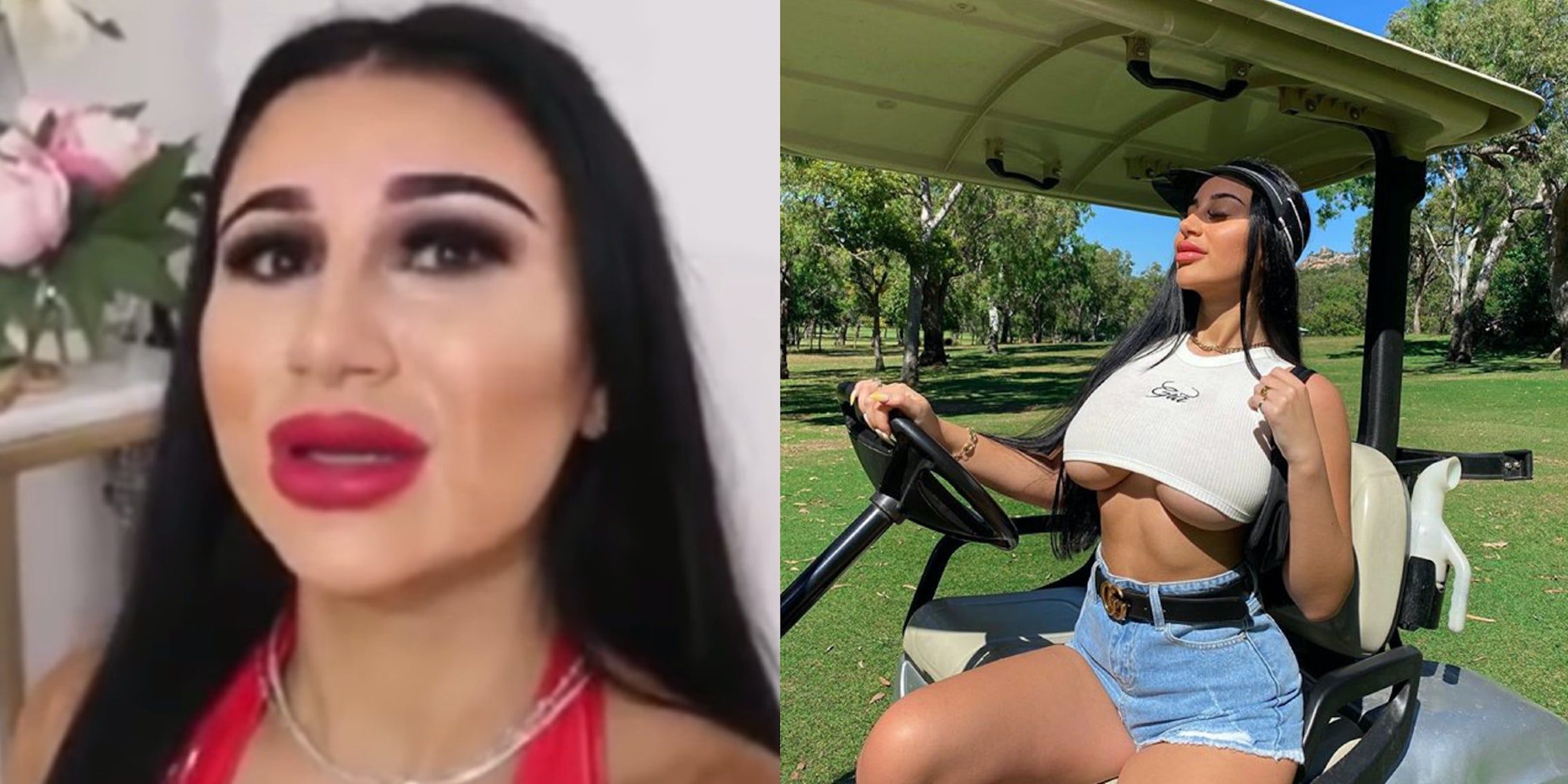 What Plastic Surgery Has Mikaela Testa Gotten? Plastic Surgery Talks