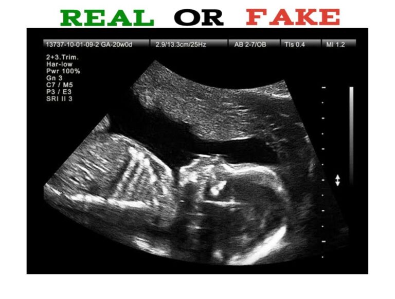 How to Spot Fake Ultrasound Picture Public Health