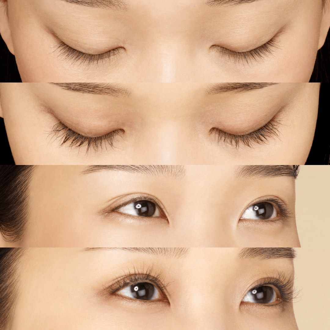 Asian Woman's Results Using Latisse for Eyelash Growing Before & After