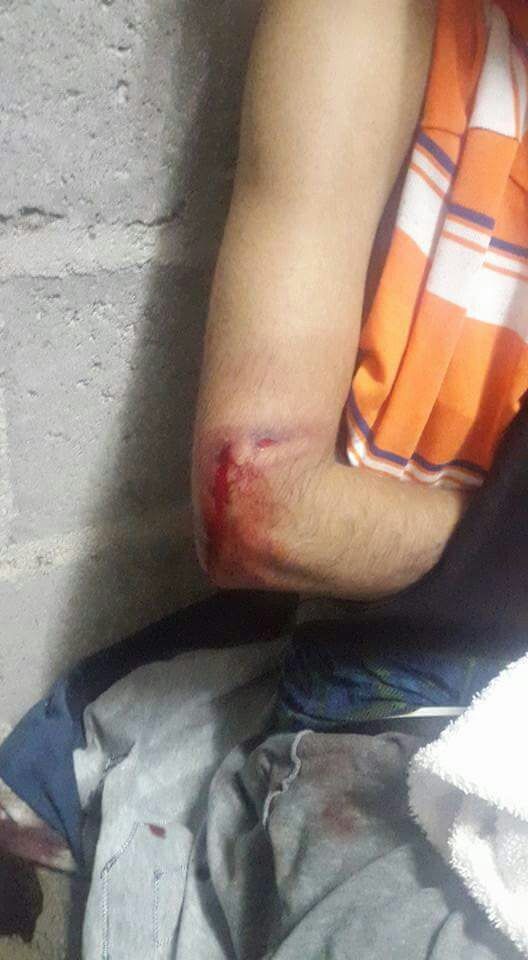herido-pedregal-1