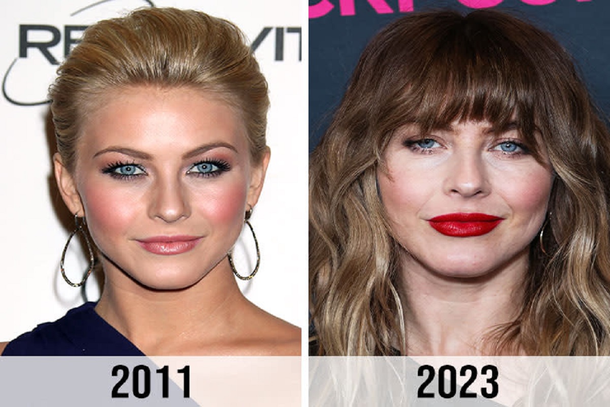Did Julianne Hough Get Plastic Surgery? Before and After Photos