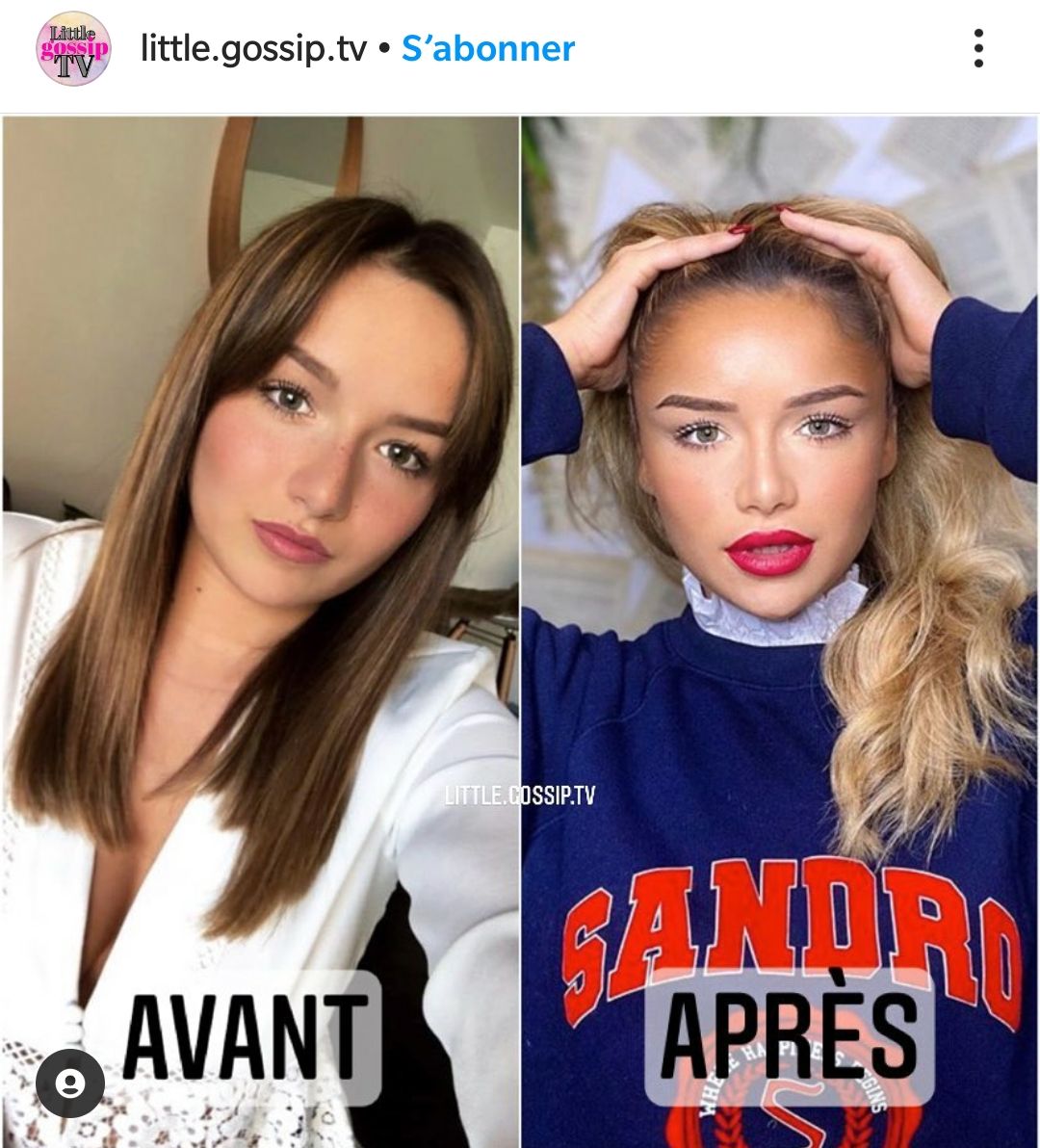 Victoria Mehault Regrette D Avoir Eu Recours A La Chirurgie Esthetique Je Ressemble A Un Pokemon