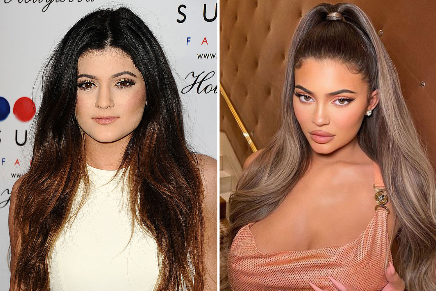 What did Kylie Jenner look like before and after lip filler? The US Sun