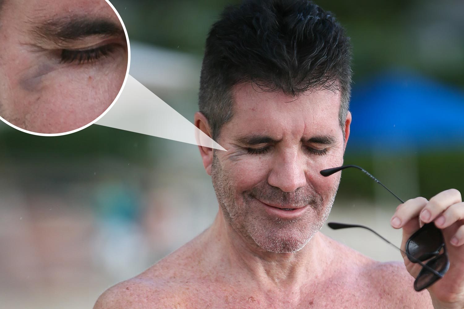 Simon Cowell gets black eye after being smacked in the face by his own front door The Irish Sun