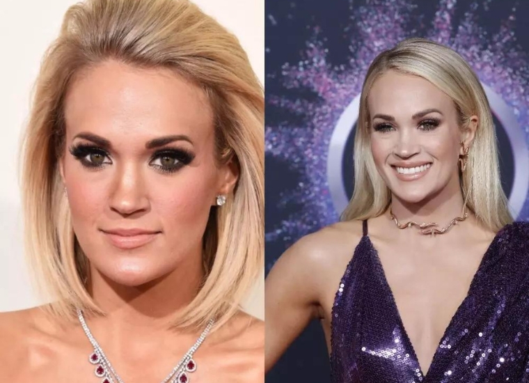 Carrie Underwood Plastic Surgery Did She Get Lip Surgery? Luv68