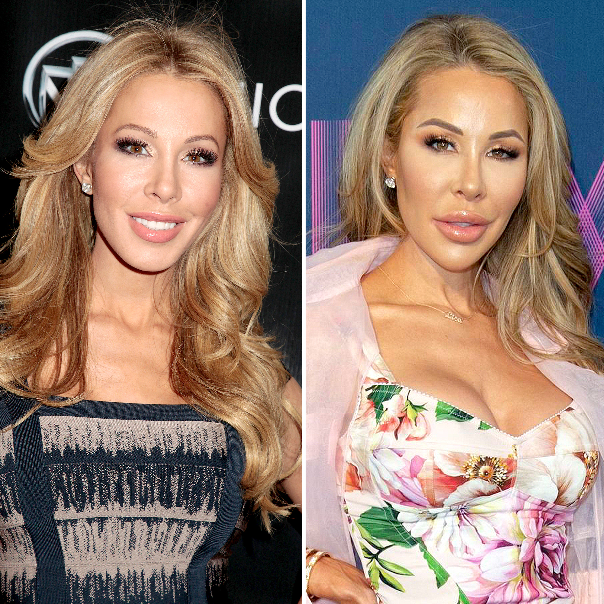 Real Housewives' Plastic Surgery Before and After Photos