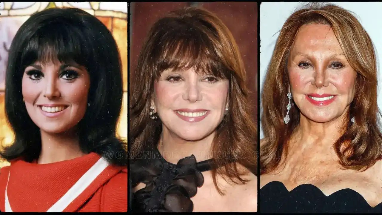 Marlo Thomas Plastic Surgery, Facelift, Nose Job, And BeforeAfter