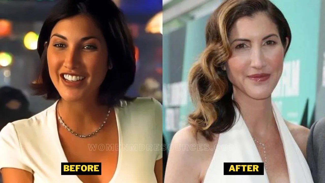 Jackie Sandler Plastic Surgery. Rumors About Adam Sandler's Wife's Botox Treatment Decoded.