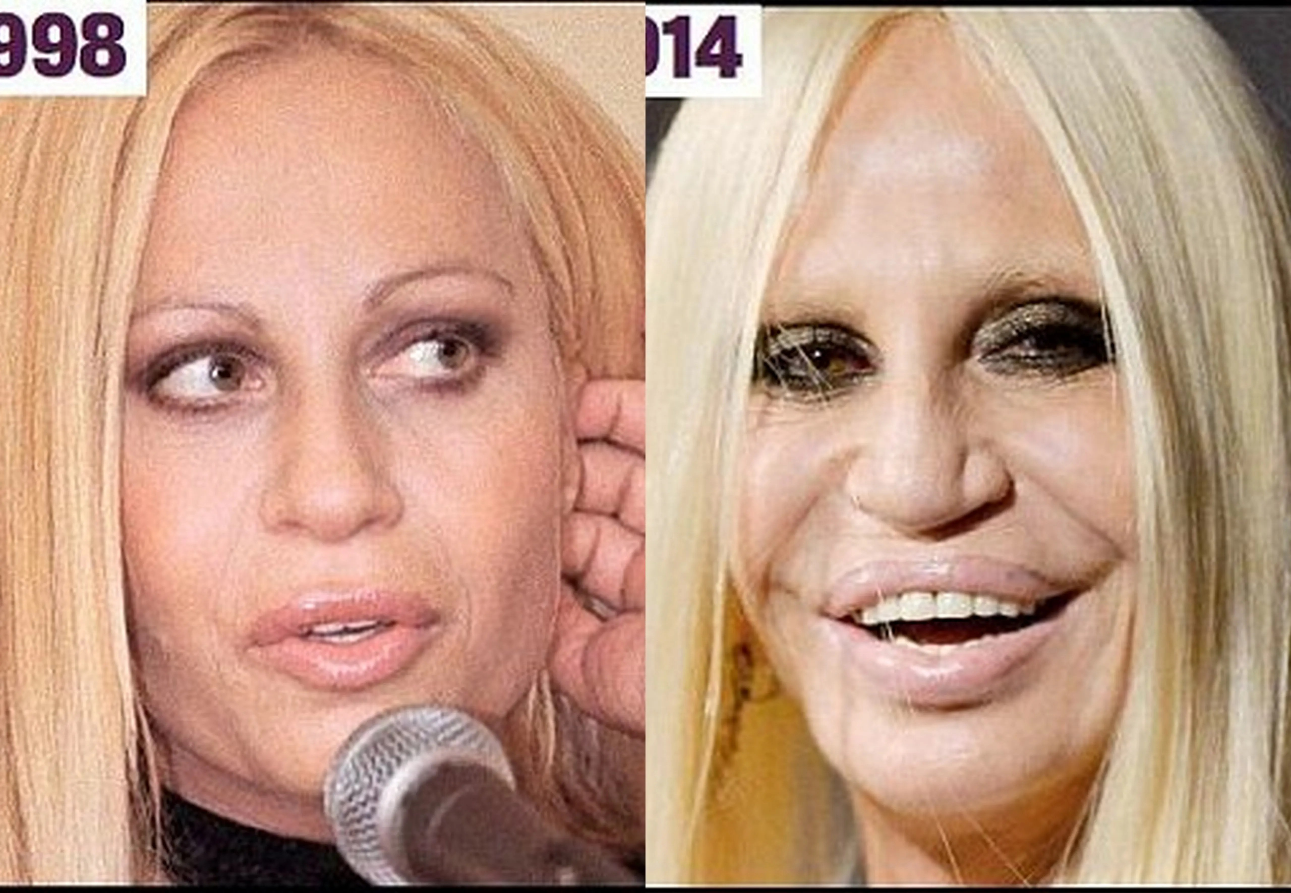 17 Celebs Who Have Had A Cosmetic Surgery Wonder Wardrobes