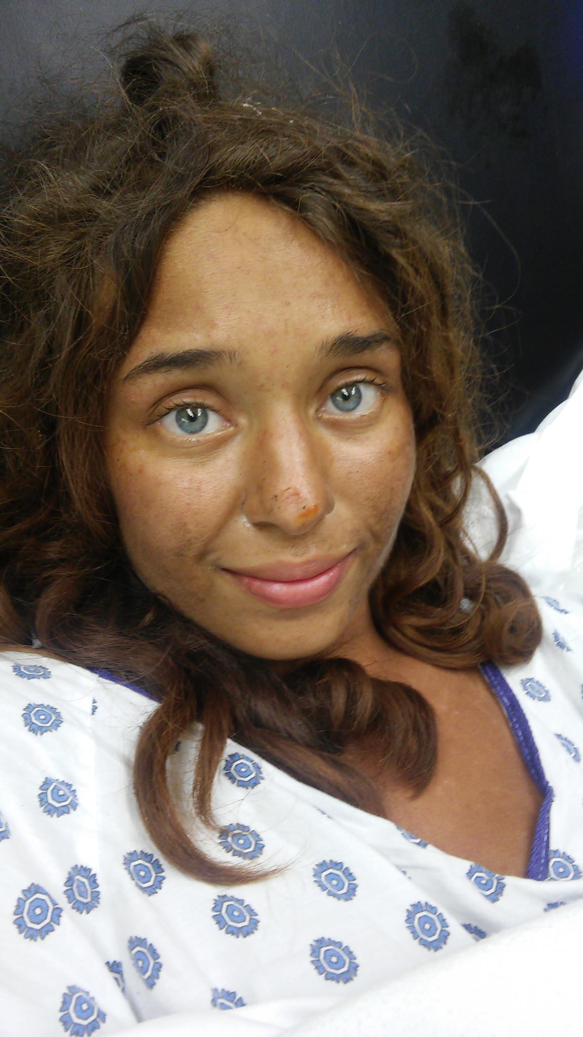 Missing Alabama Woman Survived 28 Days On Berries and Mushrooms