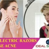 do electric razors cause acne