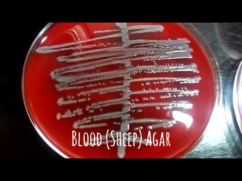 Urine Culture Microbiology Video #1