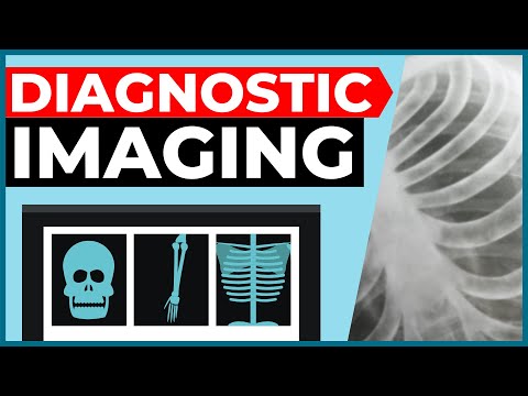 Diagnostic Imaging Explained (X-Ray / CT Scan /...
