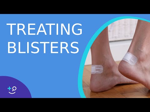 Treating Blisters - Daily Do's of Dermatology