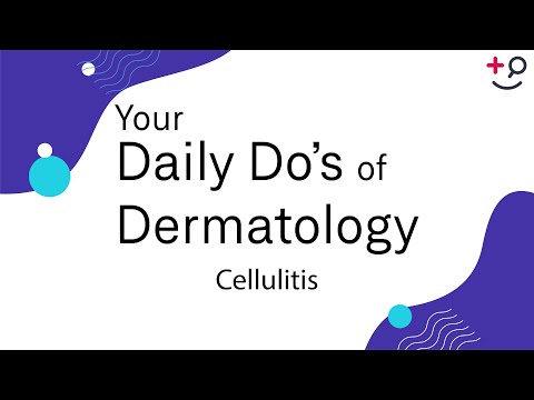 Cellulitis - Daily Do's of Dermatology