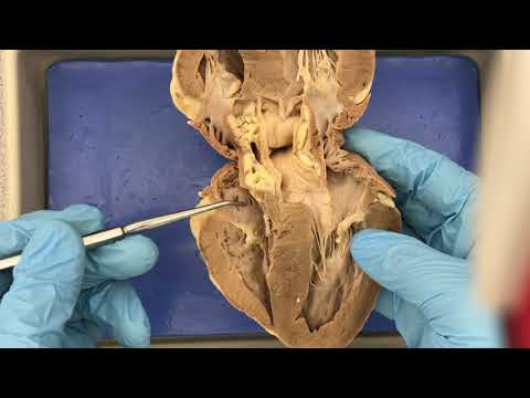 Sheep Heart and Model Anatomy Demo