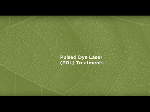 Dr. Challgren discusses Lasering - Pulse Dye Laser...