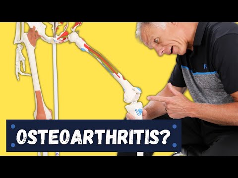 What is Causing Your Knee Pain? Osteoarthritis? How to...
