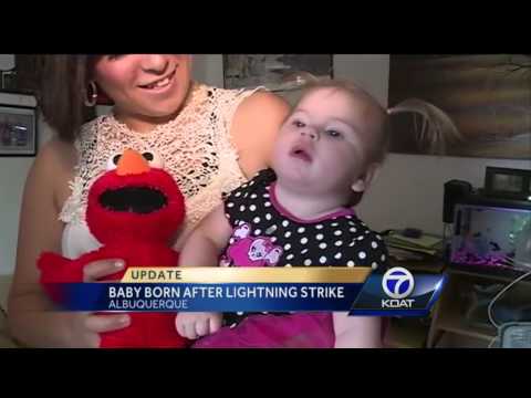 Baby struck by lightning recovering, has static hair