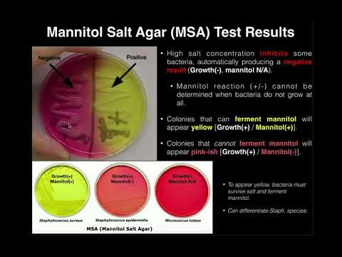 Mannitol Salt Agar (MSA) | Results & Theory