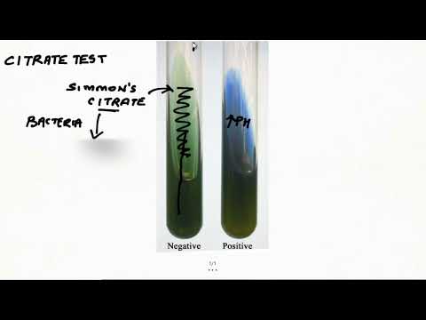 Citrate Test: 2 Minutes Microbiology: Dr. Tanmay Mehta