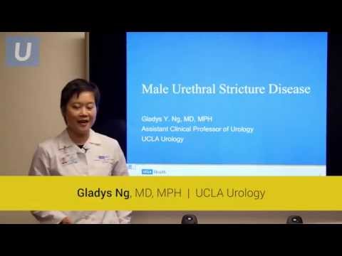 Male Urethral Stricture Disease: Signs, Symptoms and...