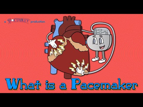 What is a Pacemaker? Lead-less pacemakers, Cardiac...