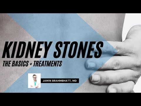What causes Kidney Stones? Basics and Treatments...