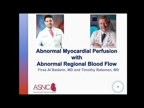 Abnormal Myocardial Perfusion with Abnormal Regional...