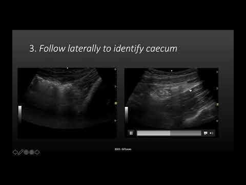 Pattern and process recognition in GUT PoCUS