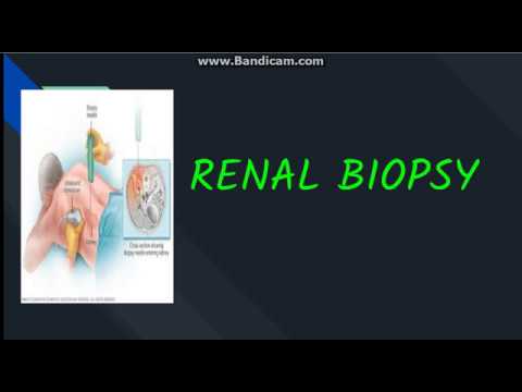 Renal Biopsy: Indication, contraindication, Procedure...