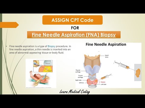 Fine Needle Aspiration CPT code 2020 | Fine Needle...