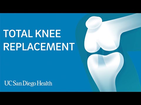 Total Knee Replacement Surgery | UC San Diego Health