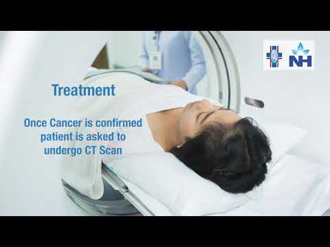 Colorectal Cancer (Colon Cancer) - Symptoms, Causes &...