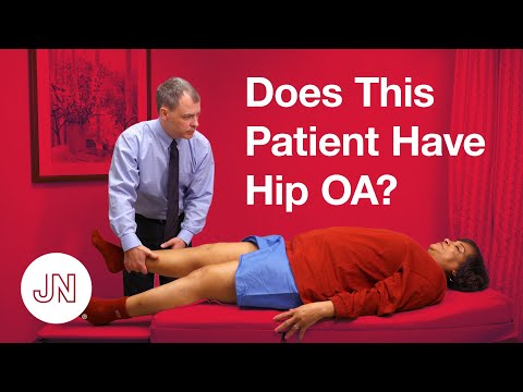 Does This Patient Have Hip Osteoarthritis?