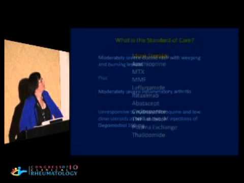 Options in Management of Mild-Moderate-Severe Lupus -...