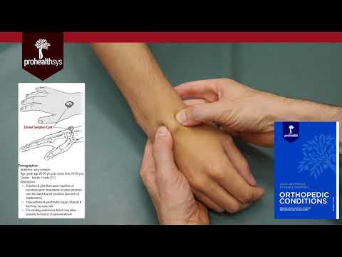 Ganglion Cyst of Wrist Diagnosis and Treatment Dr...